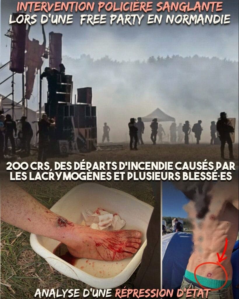 French Police Fired Flash Balls at a Rave and Blocked the Medics for a Night